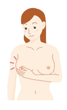 【乳房硬塊】乳房有硬塊等於乳癌？大多數屬良性纖維瘤！5個步驟自我檢查守護乳房健康